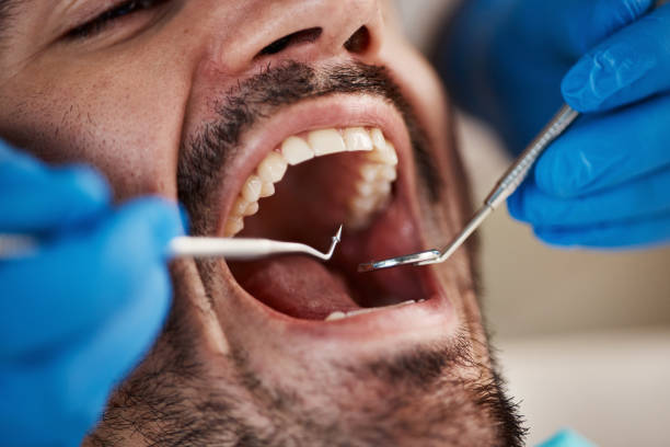 Best Knocked-Out Tooth Emergency  in Waterflow, NM